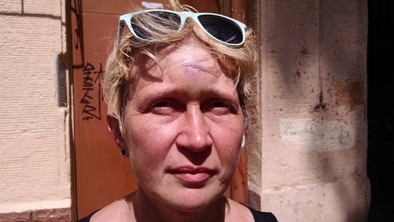 Полиция проведет расследование в связи с нападением на активистку