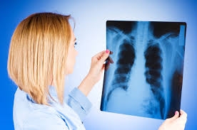 В Одессе за год выявили более 400 случаев заболевания туберкулезом