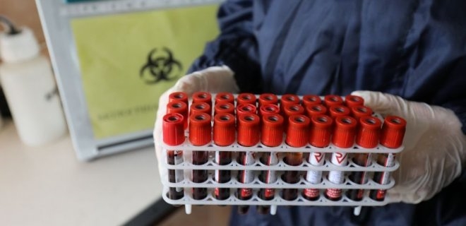 В Одессе может появиться первая государственная ПЦР-лаборатория для диагностики коронавируса