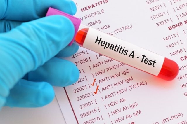 В Нерубайском произошла вспышка гепатита 