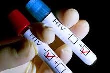В Одессе откроется новый центр интегрированной помощи ВИЧ-инфицированным