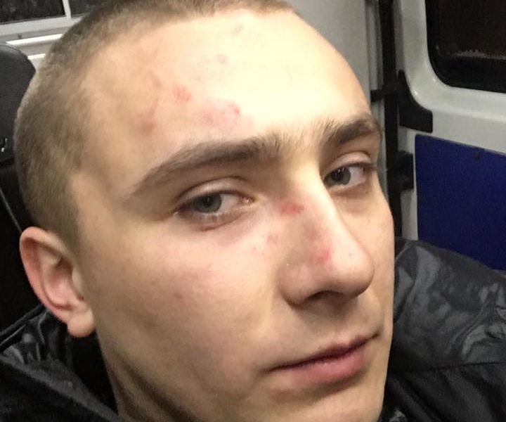 Бывшего главу "Правого сектора" побили 
